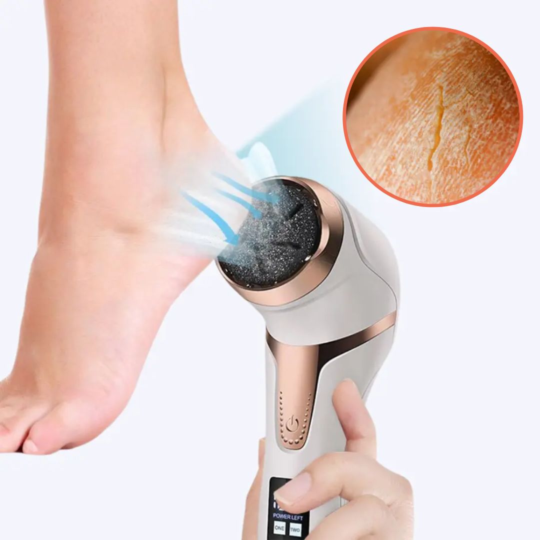 Electric Callus and Hard Skin Remover